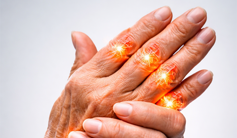 Arthritis Ayurvedic treatment