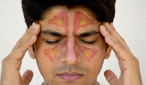 Sinusitis Ayurvedic treatment